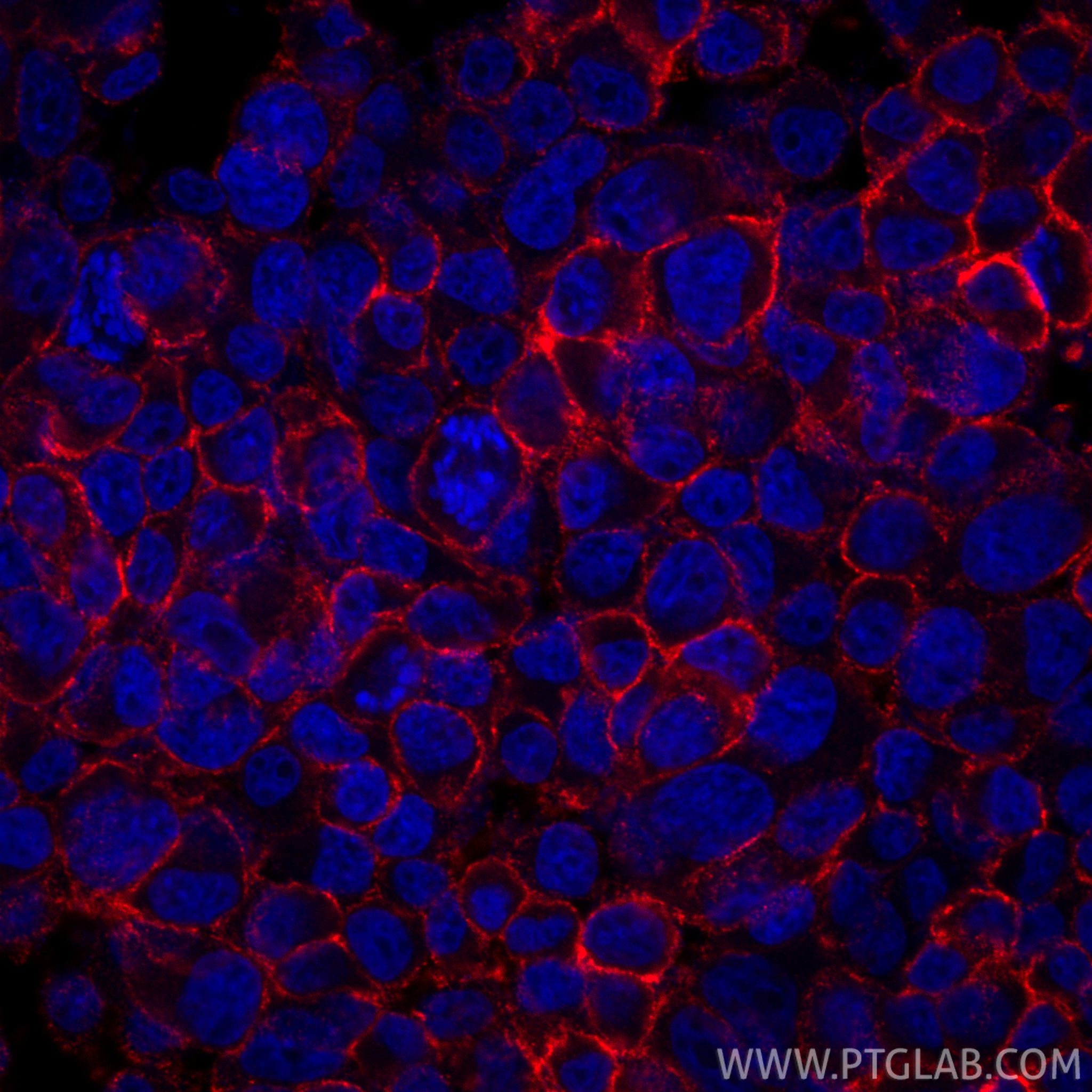 Immunofluorescent analysis of (4% PFA) fixed PC-12 cells using FXYD6 antibody (68058-1-Ig, Clone: 2H1B7 ) at dilution of 1:1000 and CoraLite®594-Conjugated Goat Anti-Mouse IgG(H+L) (<a class='green' href='/productredirect?CatalogNo=SA00013-3' target='_blank'>SA00013-3</a>). IF Staining of PC-12 using 68058-1-Ig
