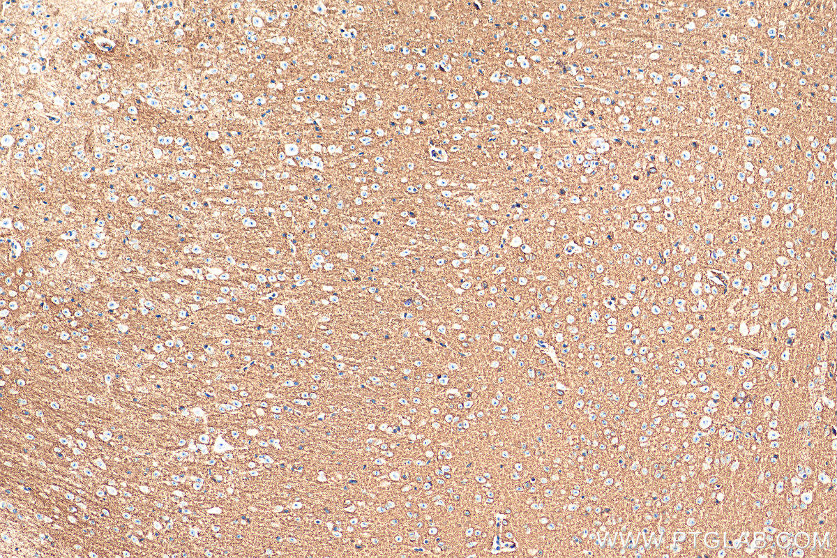 IHC staining of mouse cerebellum using 68058-1-Ig