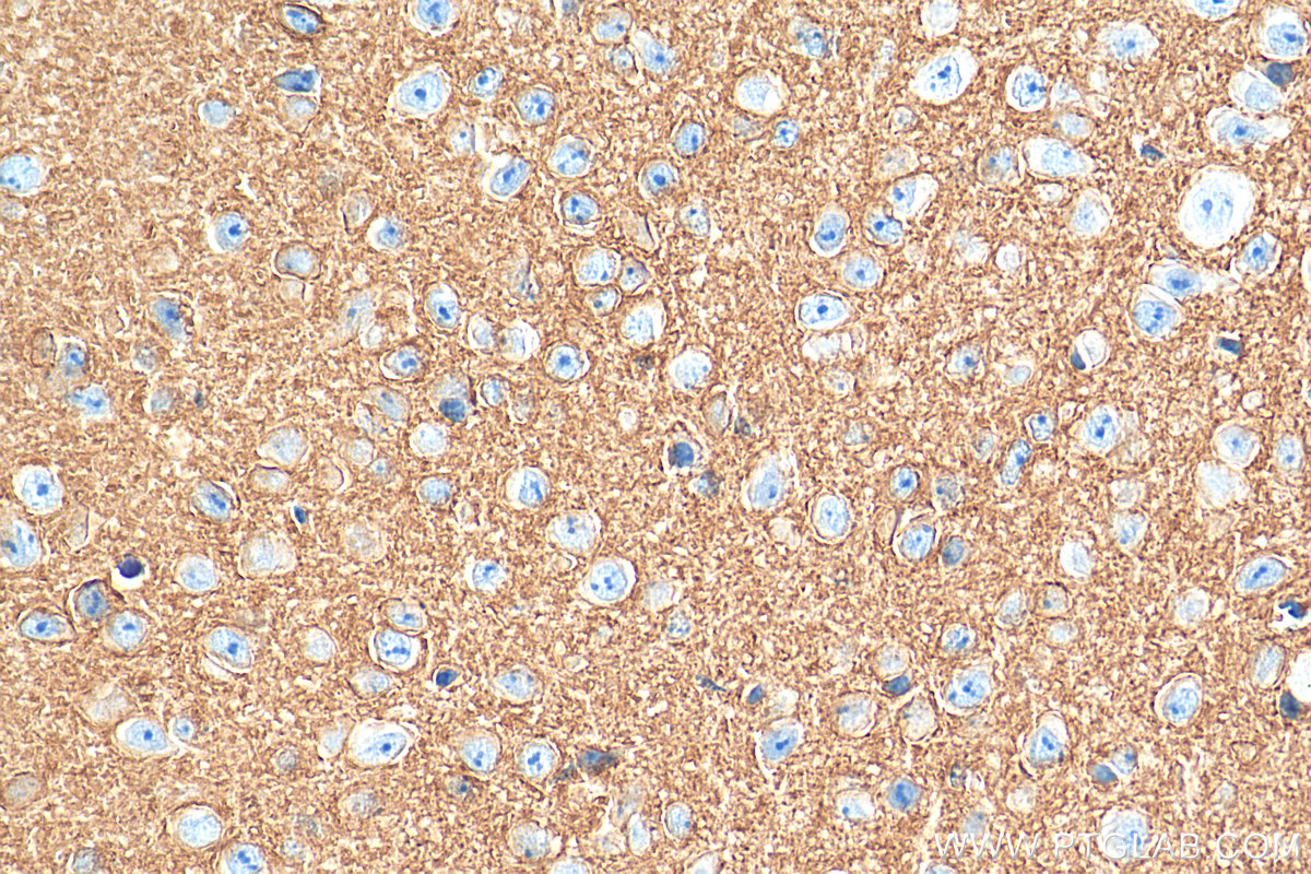 IHC staining of mouse cerebellum using 68058-1-Ig