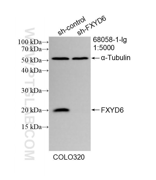 WB analysis of COLO 320 using 68058-1-Ig