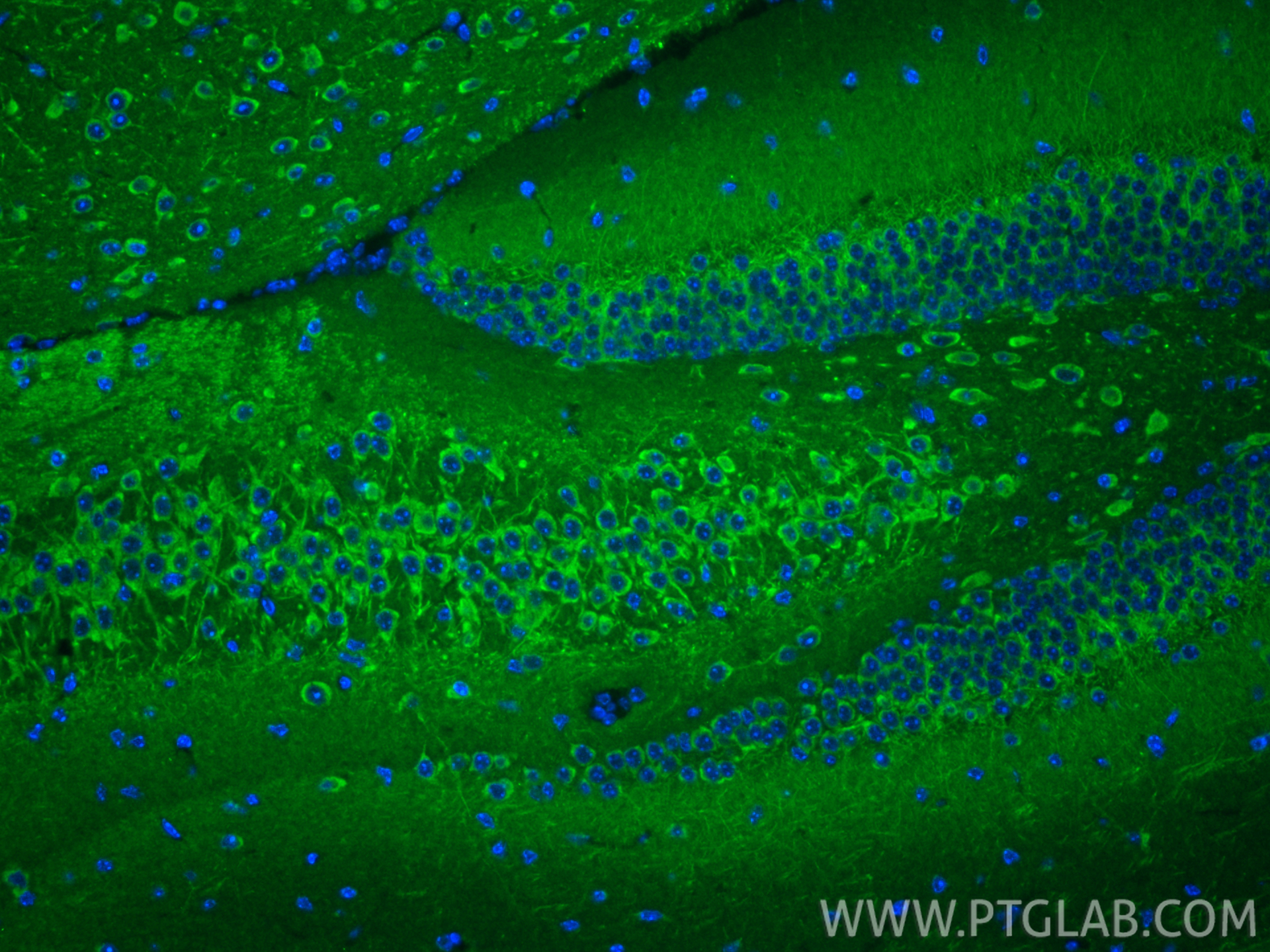 IF Staining of mouse brain using 11465-1-AP IF Staining of mouse brain using 11465-1-AP