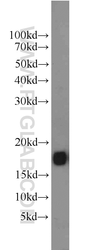 WB analysis of mouse brain using 11465-1-AP