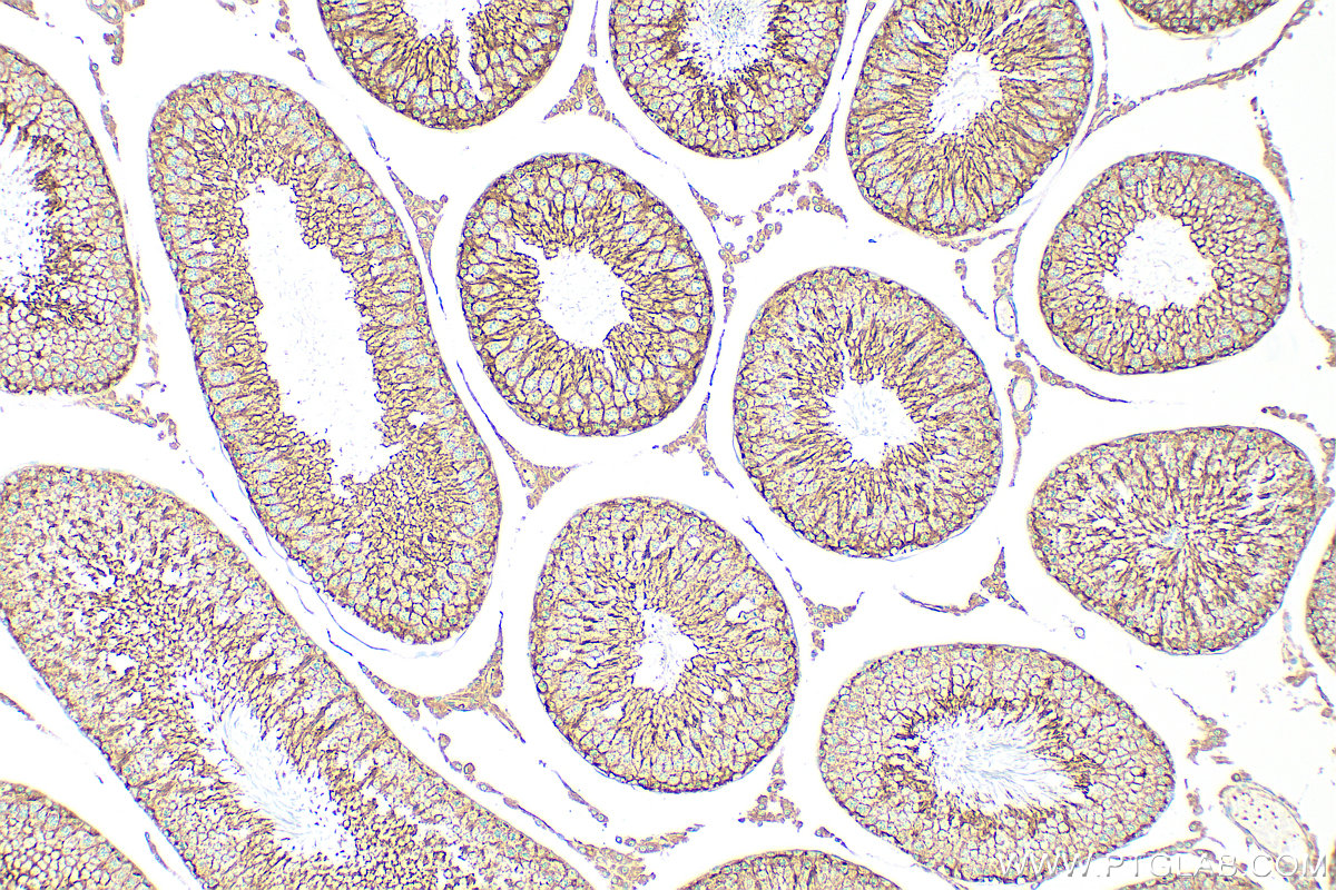 IHC staining of rat testis using 17237-1-AP