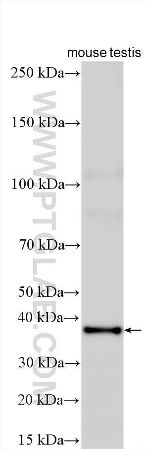 WB analysis using 24560-1-AP WB analysis using 24560-1-AP
