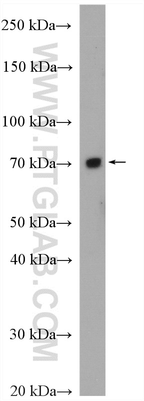 WB analysis of HeLa using 28326-1-AP