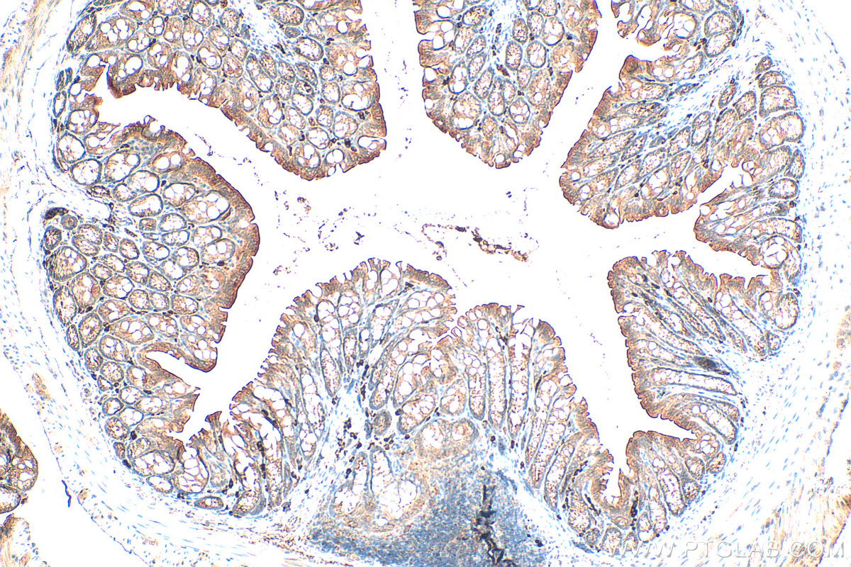 IHC staining of mouse colon using 24272-1-AP