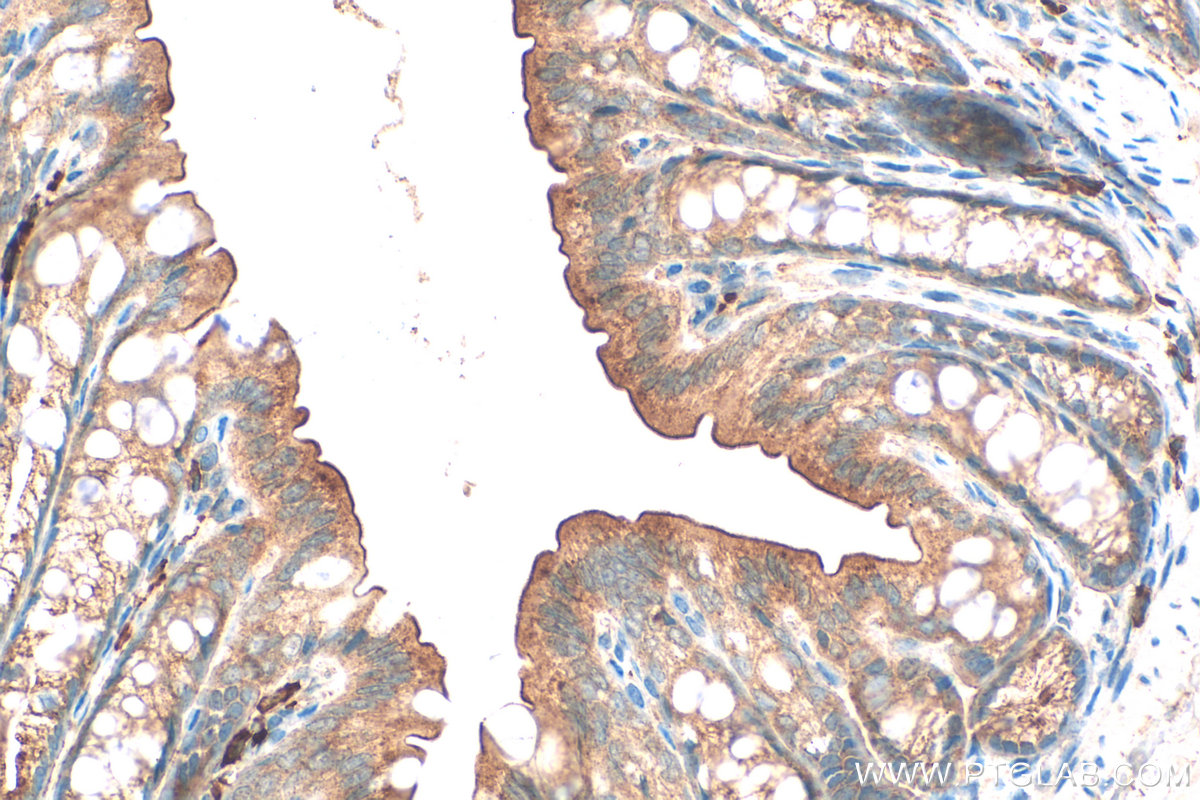 IHC staining of mouse colon using 24272-1-AP