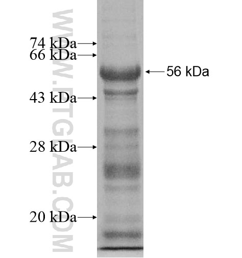 Frizzled 4 fusion protein Ag15402 SDS-PAGE Frizzled 4 fusion protein Ag15402 SDS-PAGE