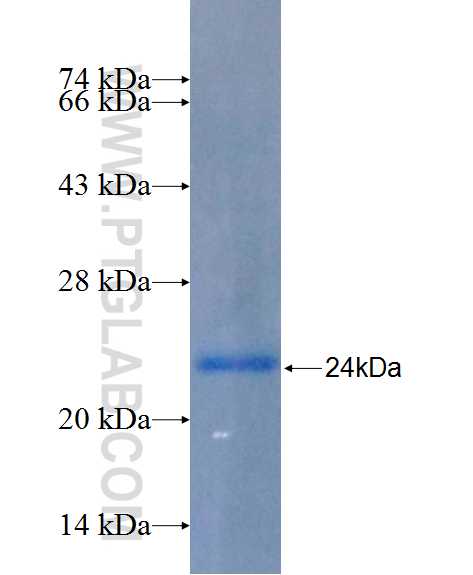 FZD6 fusion protein Ag26259 SDS-PAGE FZD6 fusion protein Ag26259 SDS-PAGE