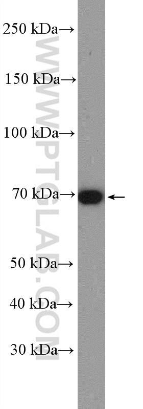 Frizzled 8 Polyclonal antibody