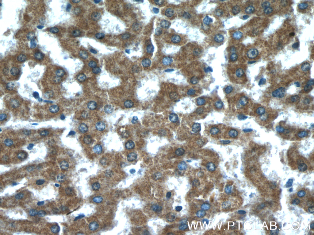 IHC staining of human liver using 16368-1-AP