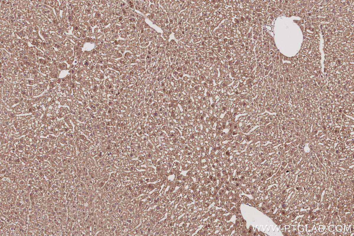 IHC staining of mouse liver using 16368-1-AP IHC staining of mouse liver using 16368-1-AP
