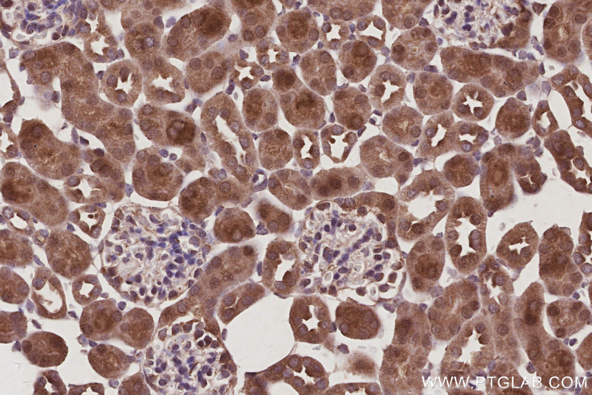 IHC staining of mouse kidney using 16368-1-AP IHC staining of mouse kidney using 16368-1-AP