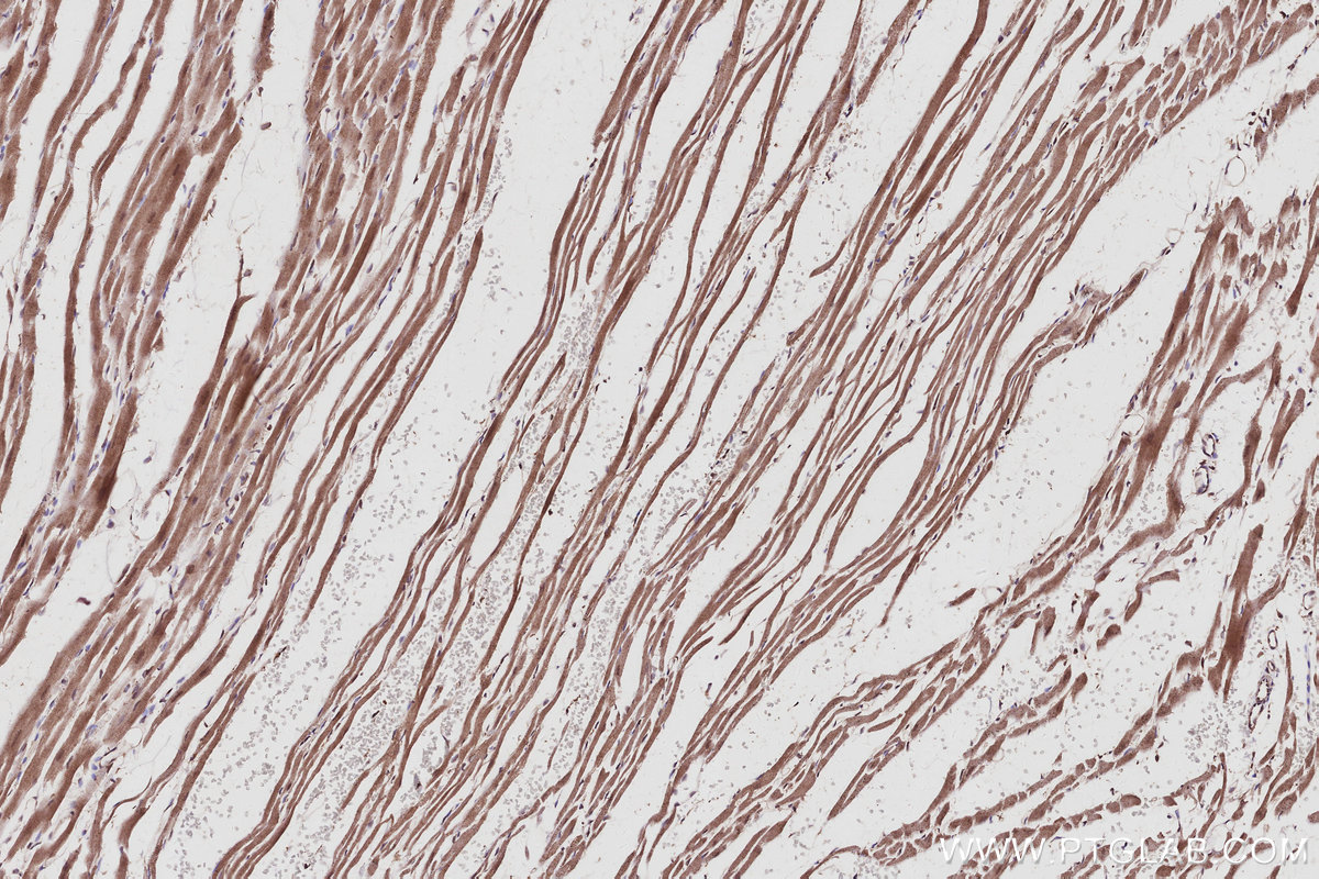 IHC staining of rat heart using 16368-1-AP IHC staining of rat heart using 16368-1-AP