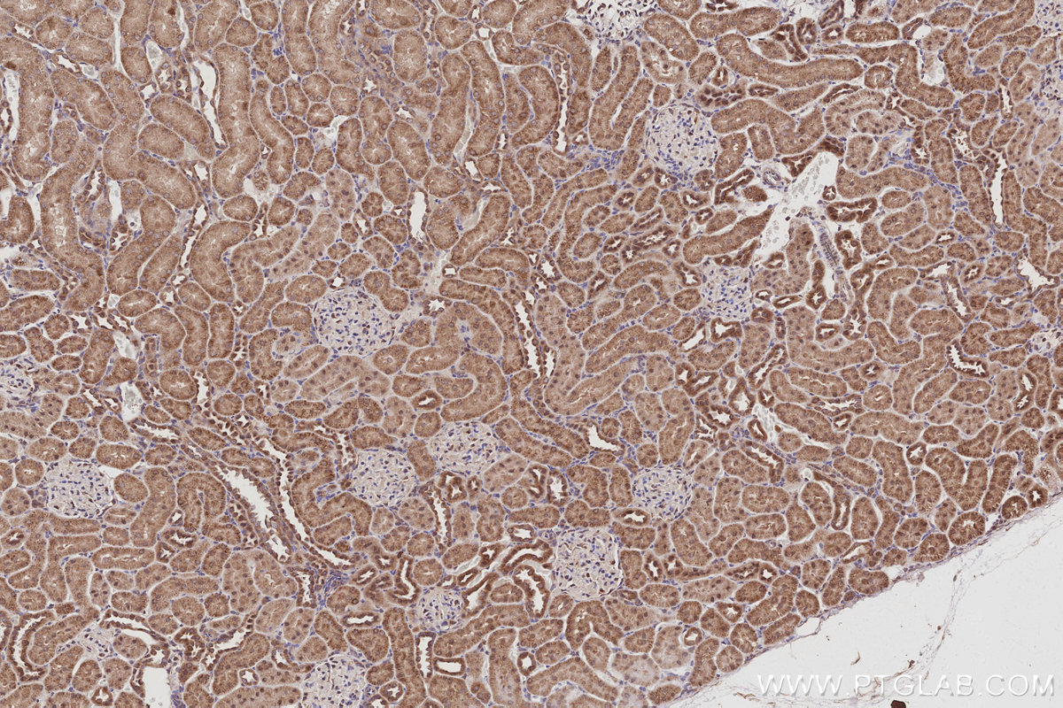 IHC staining of rat kidney using 16368-1-AP IHC staining of rat kidney using 16368-1-AP