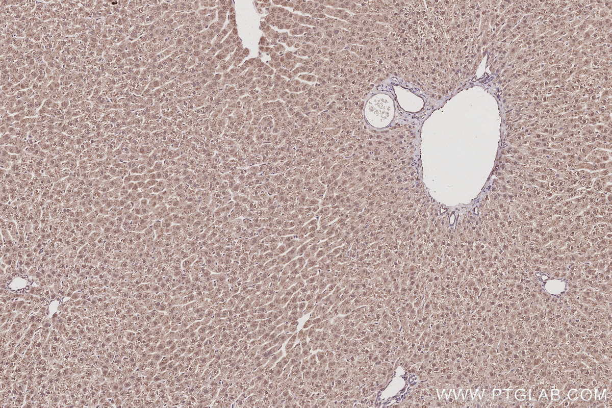 IHC staining of rat liver using 16368-1-AP IHC staining of rat liver using 16368-1-AP