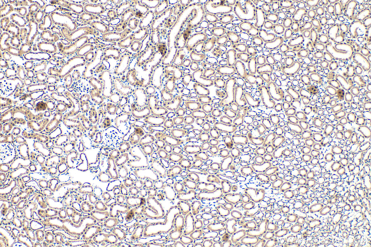 IHC staining of mouse kidney using 16368-1-AP