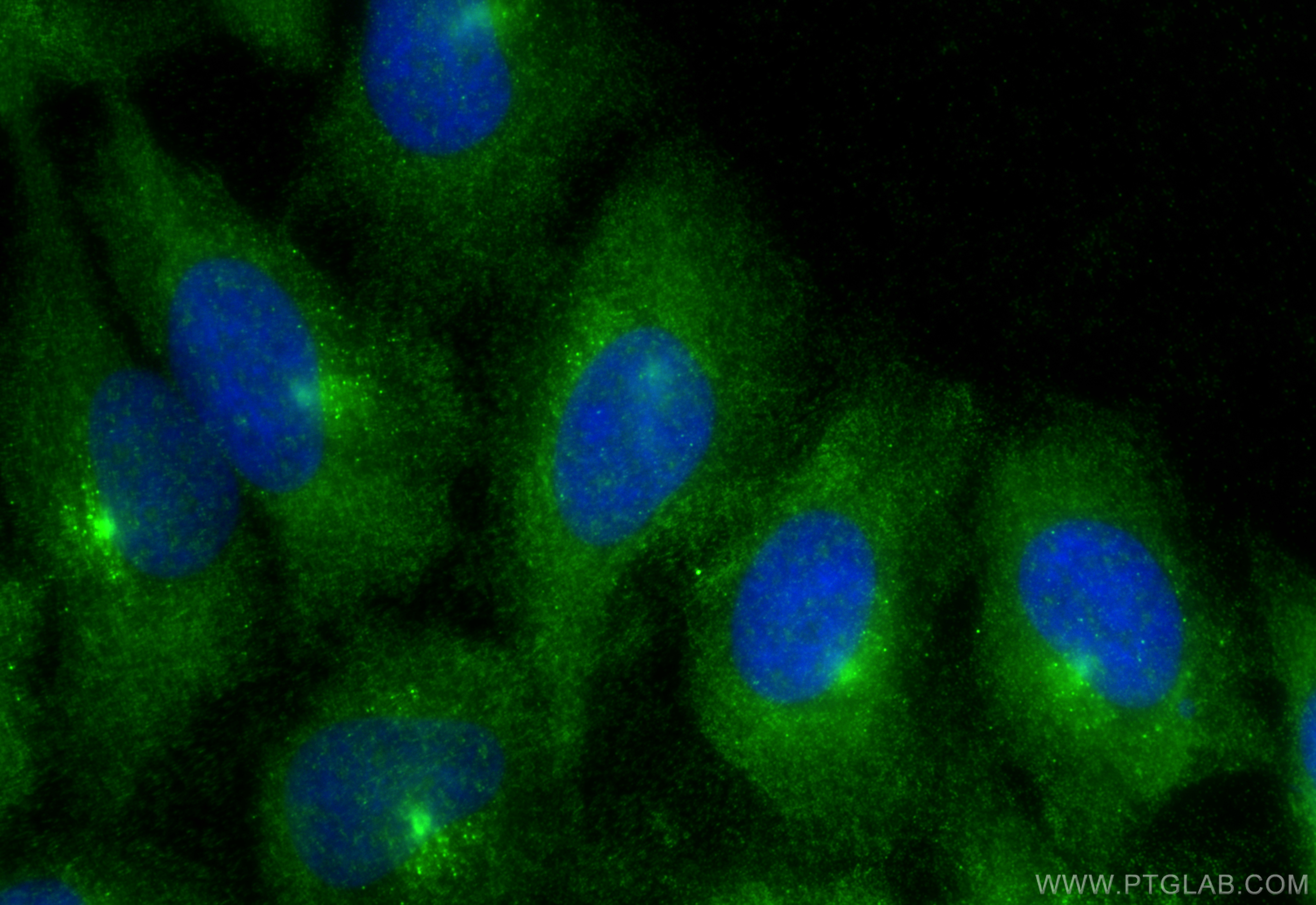 Immunofluorescent analysis of (-20°C Ethanol) fixed HeLa cells using Factor IX/PTC antibody (32051-1-AP) at dilution of 1:400 and CoraLite®488-Conjugated Goat Anti-Rabbit IgG(H+L) (<a class='green' href='/productredirect?CatalogNo=SA00013-2' target='_blank'>SA00013-2</a>). IF Staining of HeLa using 32051-1-AP