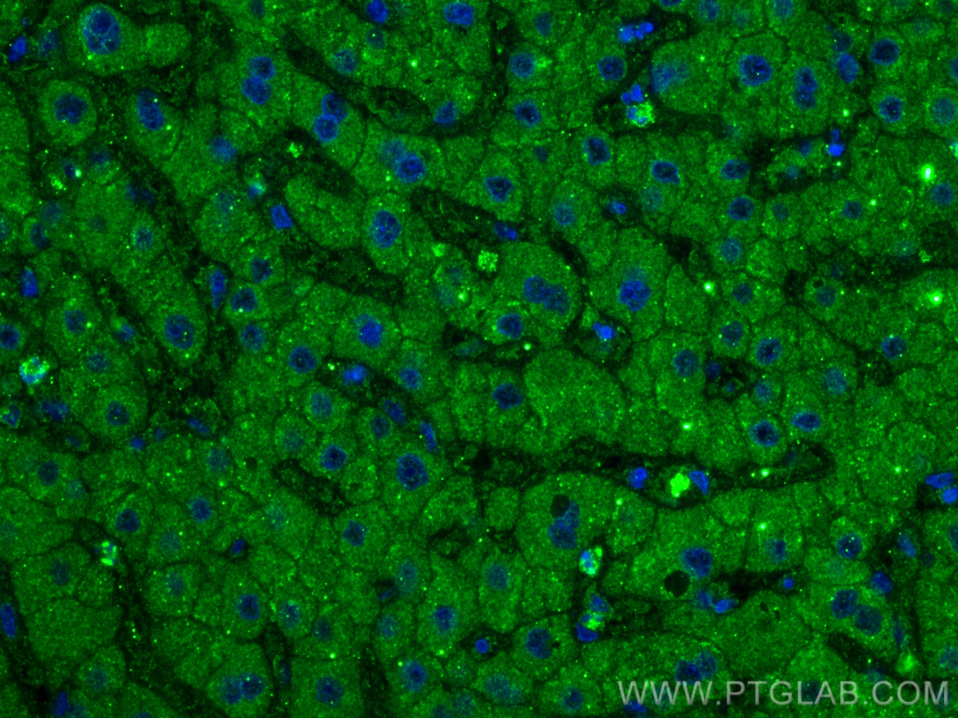 IF Staining of human liver using 66753-1-Ig