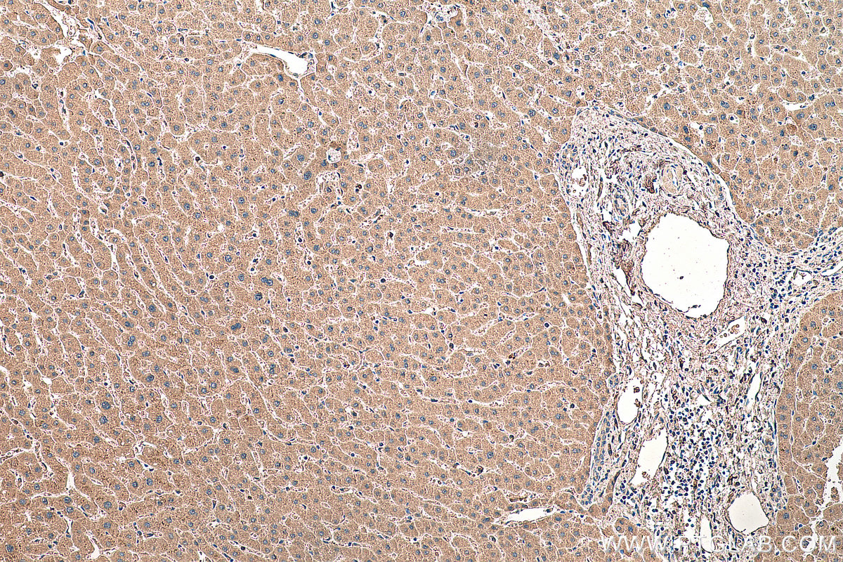 IHC staining of human liver using 66753-1-Ig