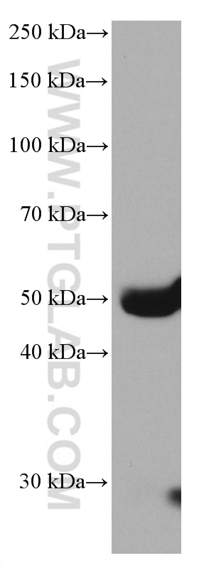 WB analysis of human plasma using 66753-1-Ig