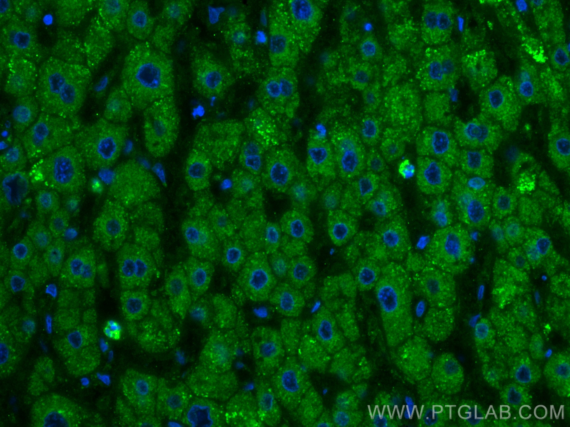 IF Staining of human liver using CL488-66753