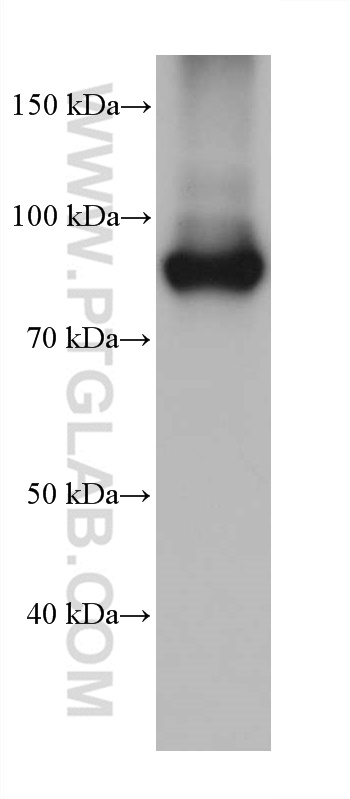 WB analysis of human peripheral blood platelets using 66325-1-Ig