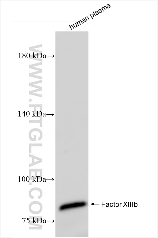 WB analysis of human plasma using 84273-1-RR