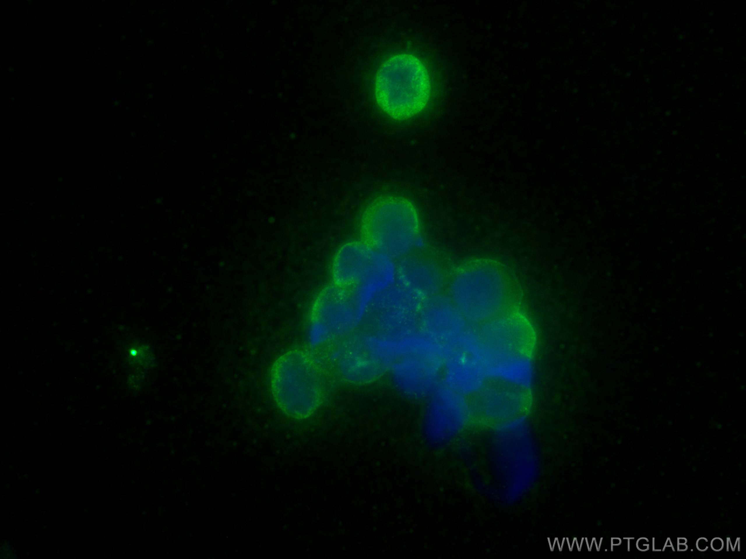 IF Staining of Raji using 30601-1-AP