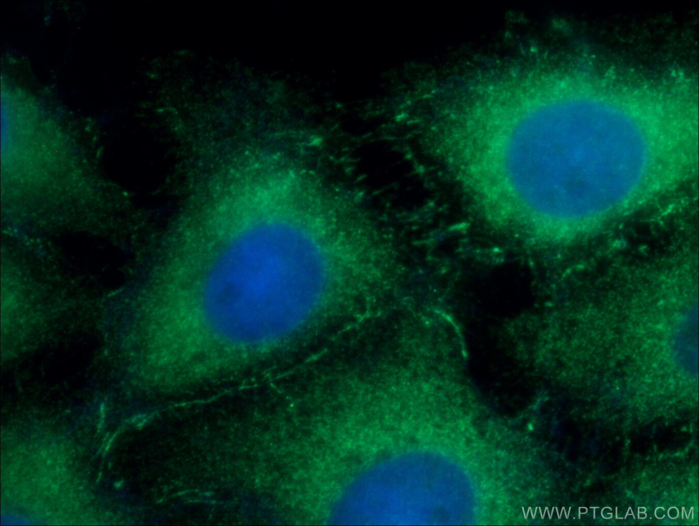 IF Staining of SH-SY5Y using 66321-1-Ig