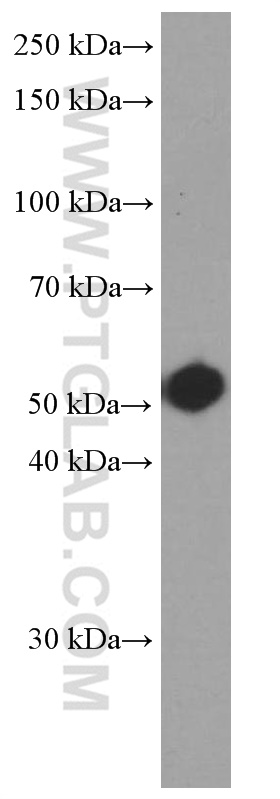 WB analysis of SH-SY5Y using 66321-1-Ig