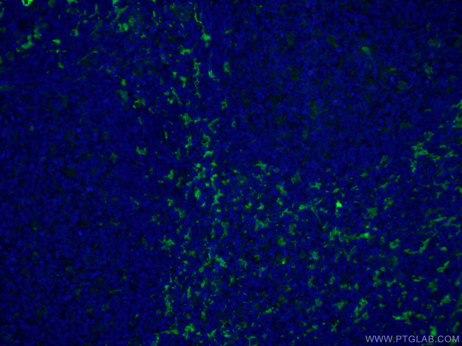 IF Staining of human tonsillitis using CL488-66321