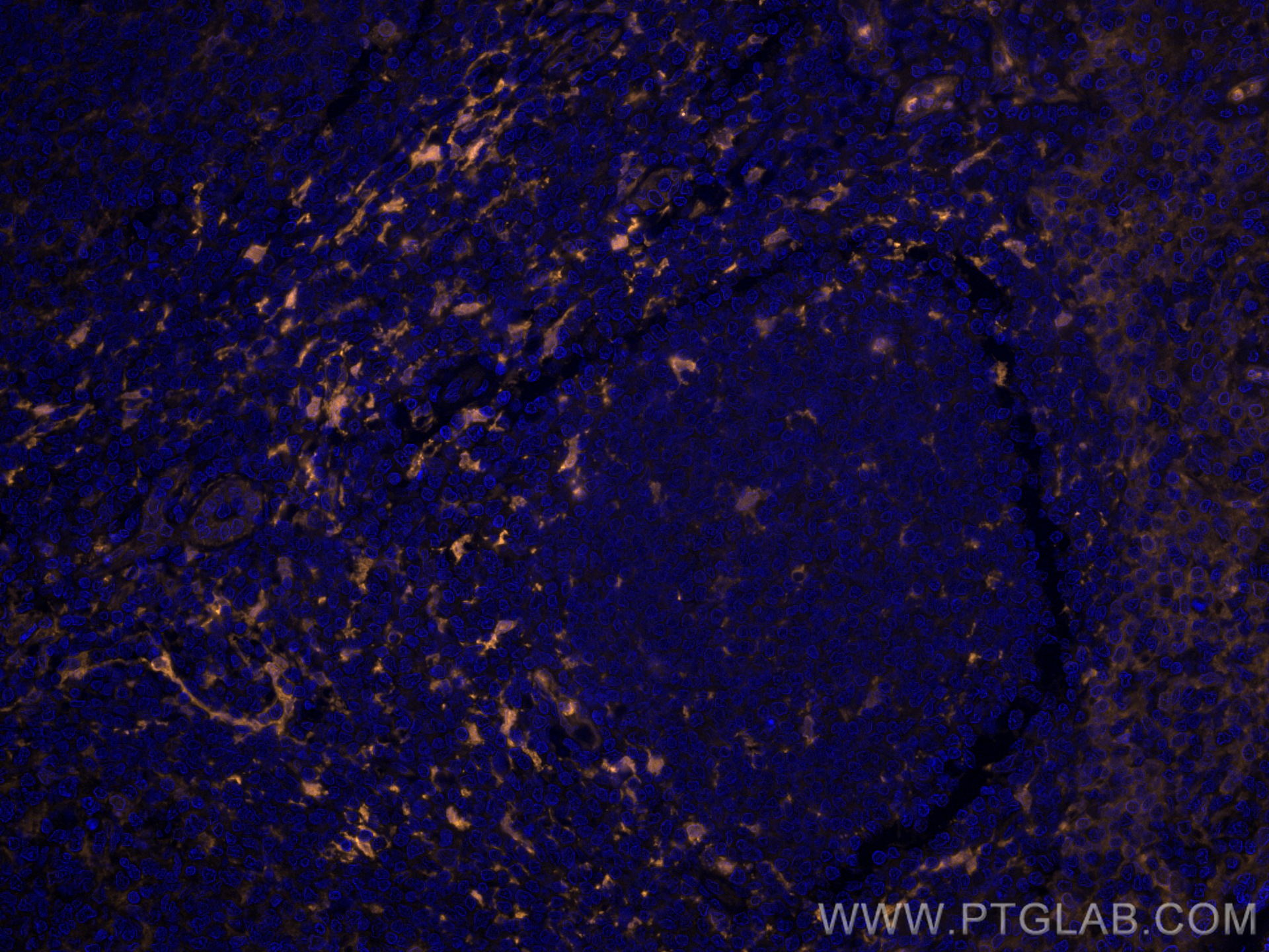 IF Staining of human tonsillitis using CL555-66321