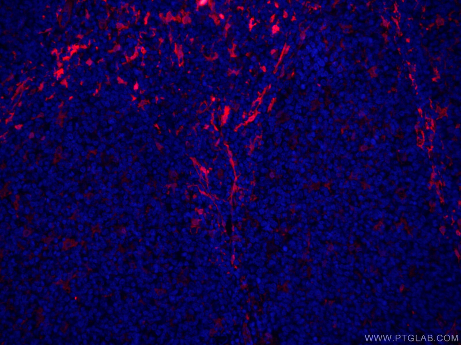 IF Staining of human tonsillitis using CL594-66321