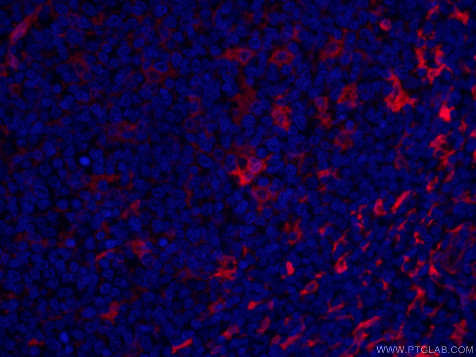 IF Staining of human tonsillitis using CL594-66321