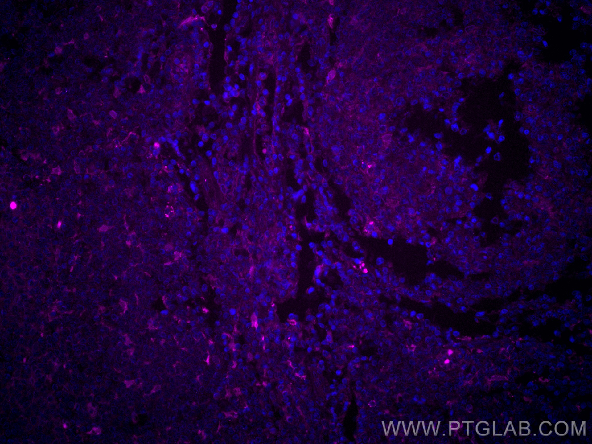 IF Staining of human tonsillitis using CL647-66321