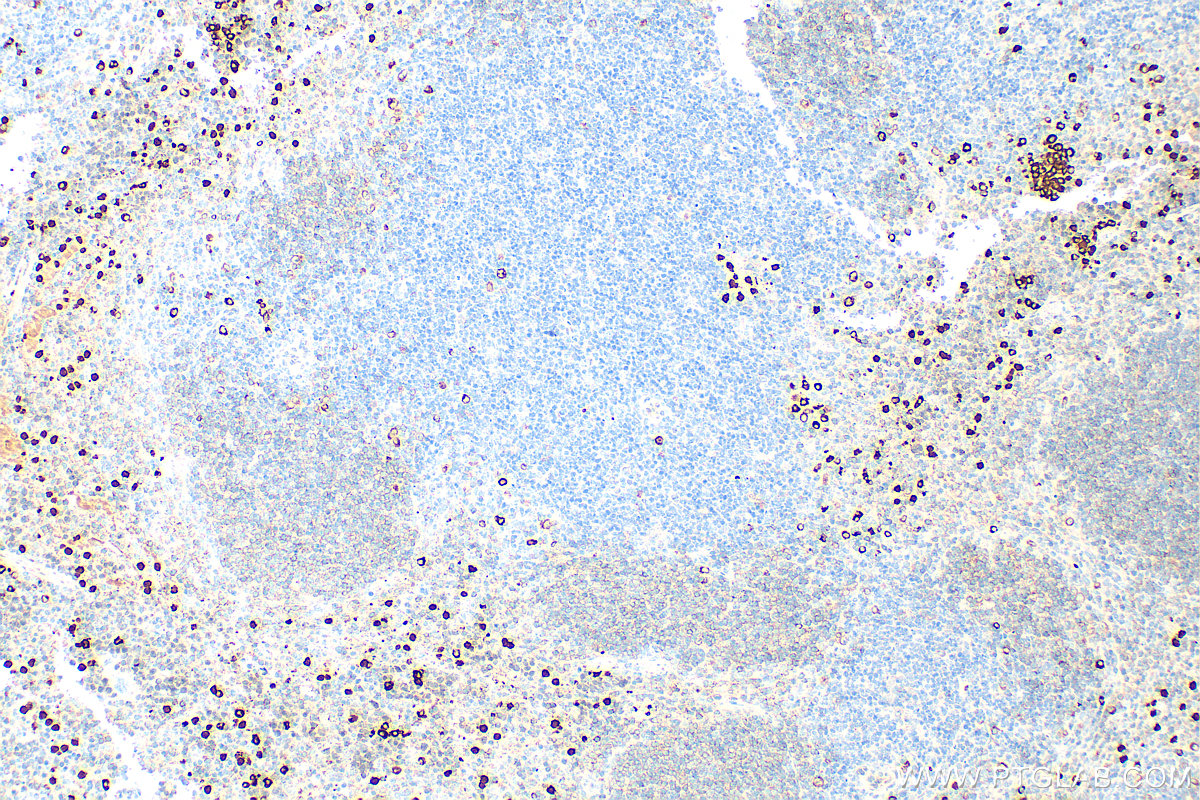 IHC staining of mouse spleen using 32501-1-AP