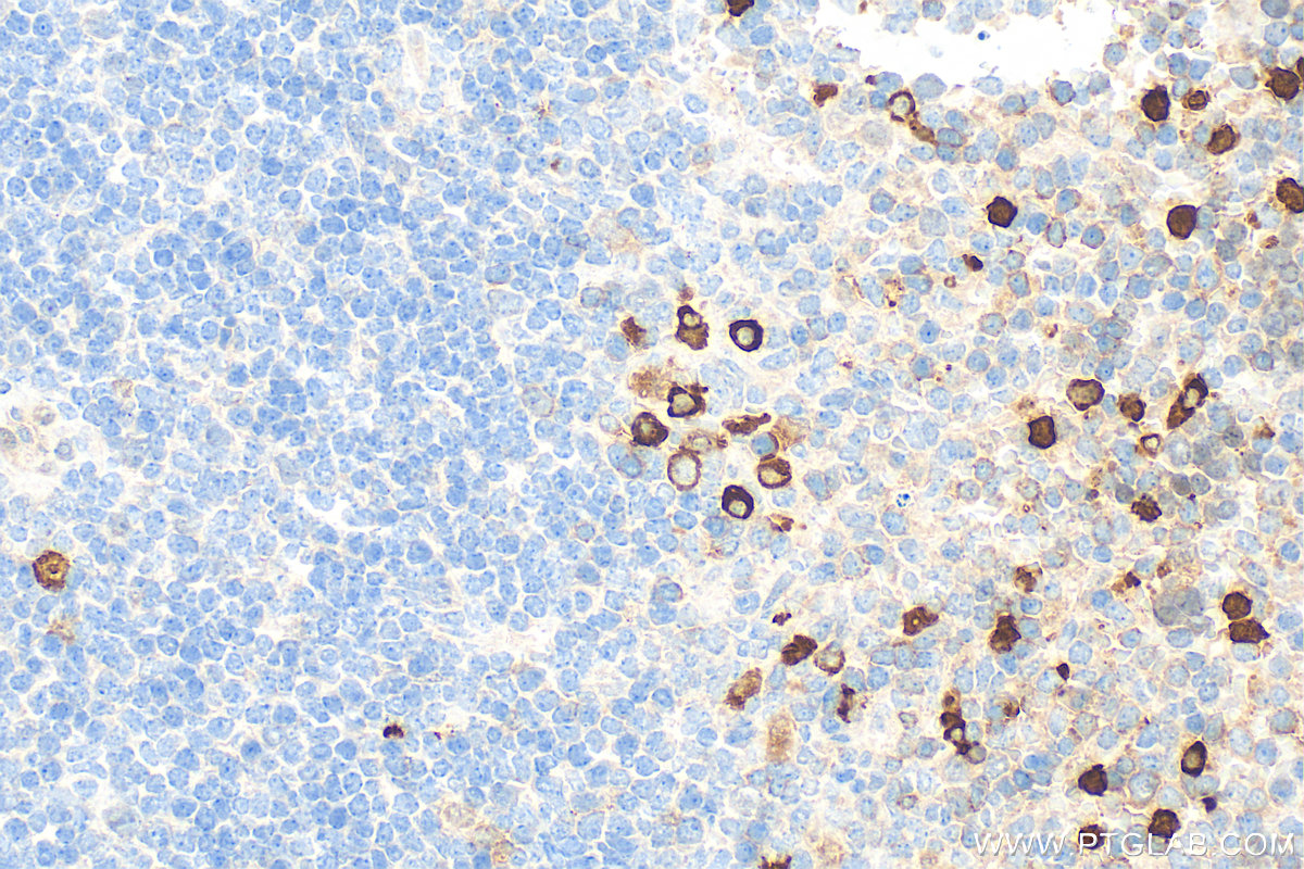 IHC staining of mouse spleen using 32501-1-AP
