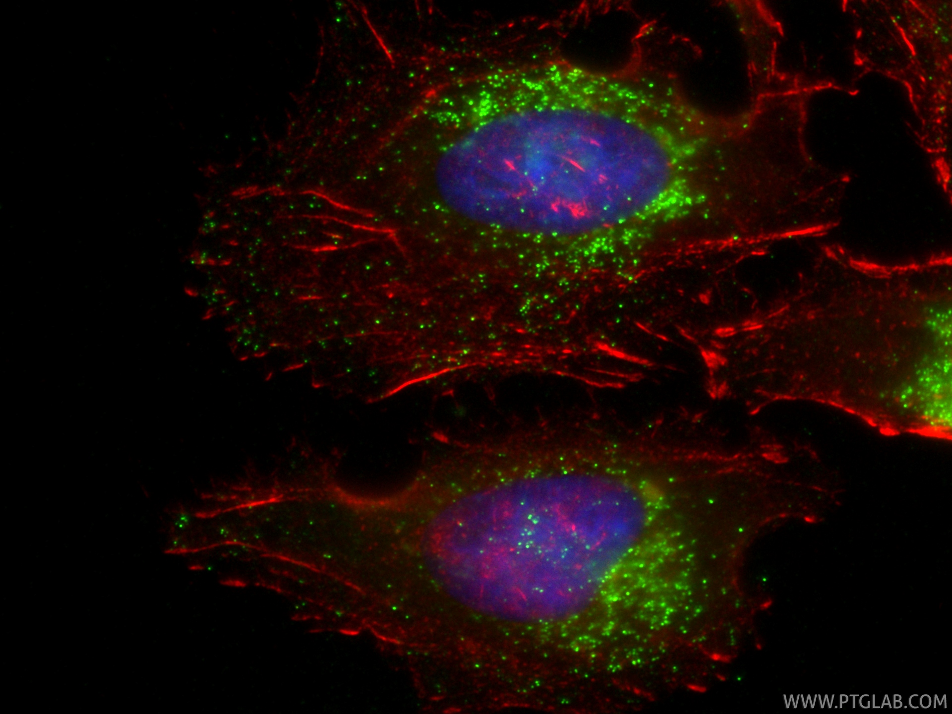 IF Staining of HeLa using CL488-83428