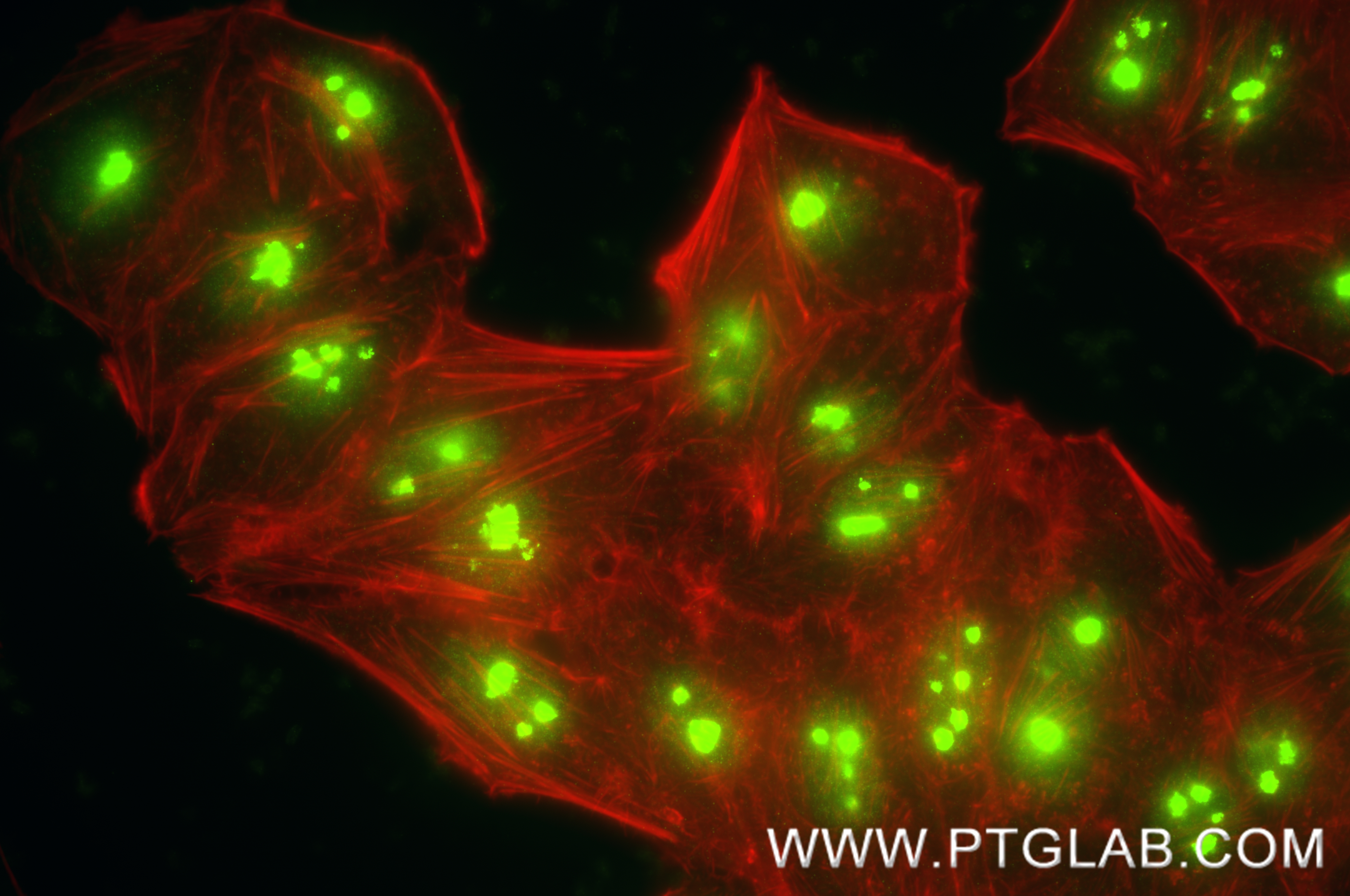 IF Staining of HepG2 using 87432-2-RR (same clone as 87432-2-PBS) IF Staining of HepG2 using 87432-2-RR (same clone as 87432-2-PBS)
