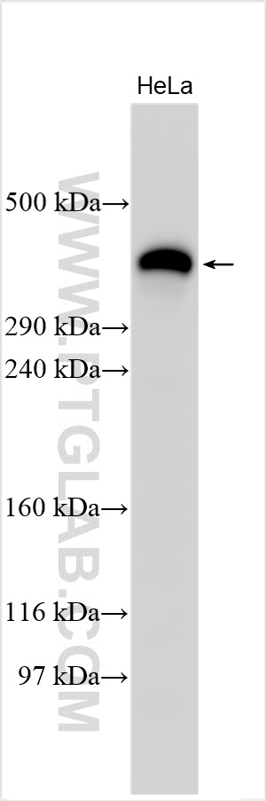 WB analysis using 29425-1-AP (same clone as 29425-1-PBS)