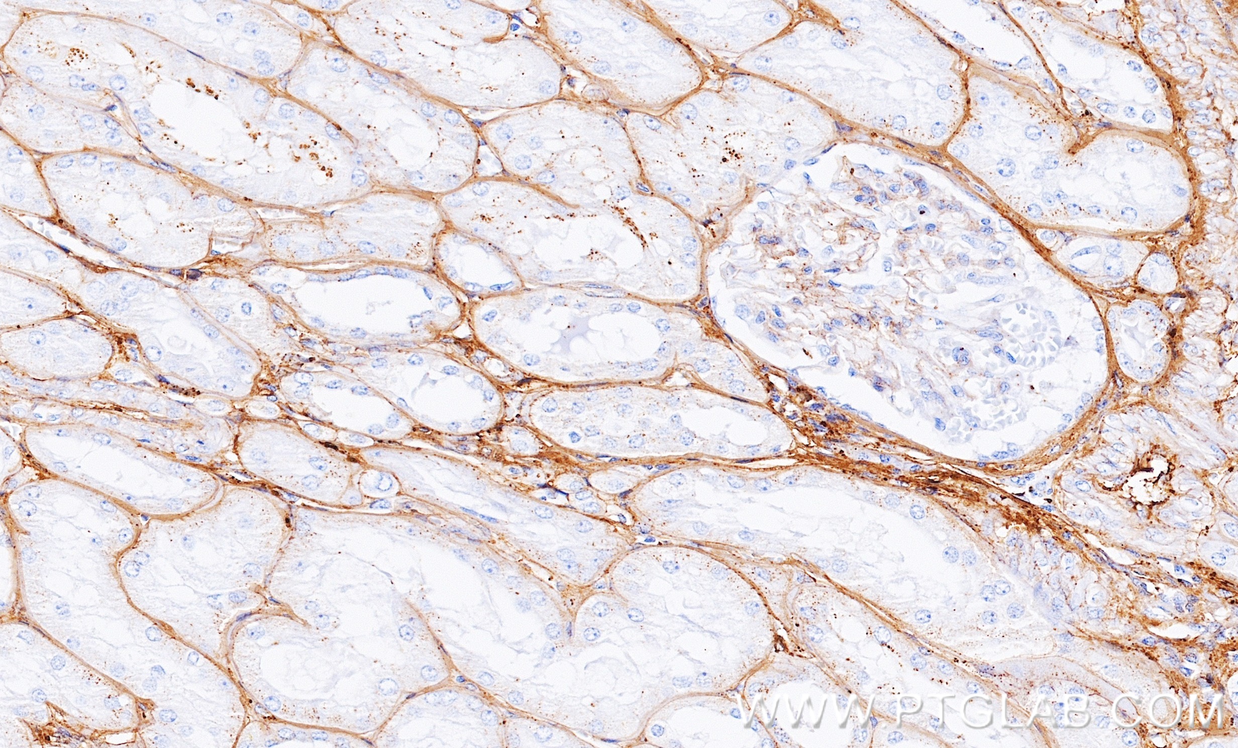 IHC staining of human kidney using 86913-6-RR (same clone as 86913-6-PBS) IHC staining of human kidney using 86913-6-RR (same clone as 86913-6-PBS)