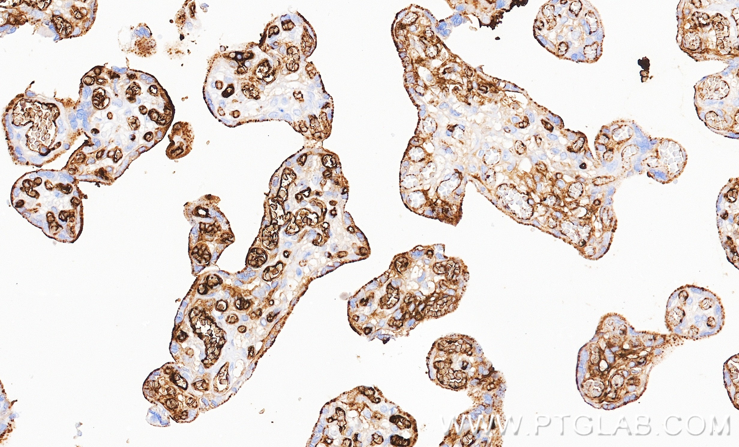 IHC staining of human placenta using 86913-6-RR (same clone as 86913-6-PBS) IHC staining of human placenta using 86913-6-RR (same clone as 86913-6-PBS)
