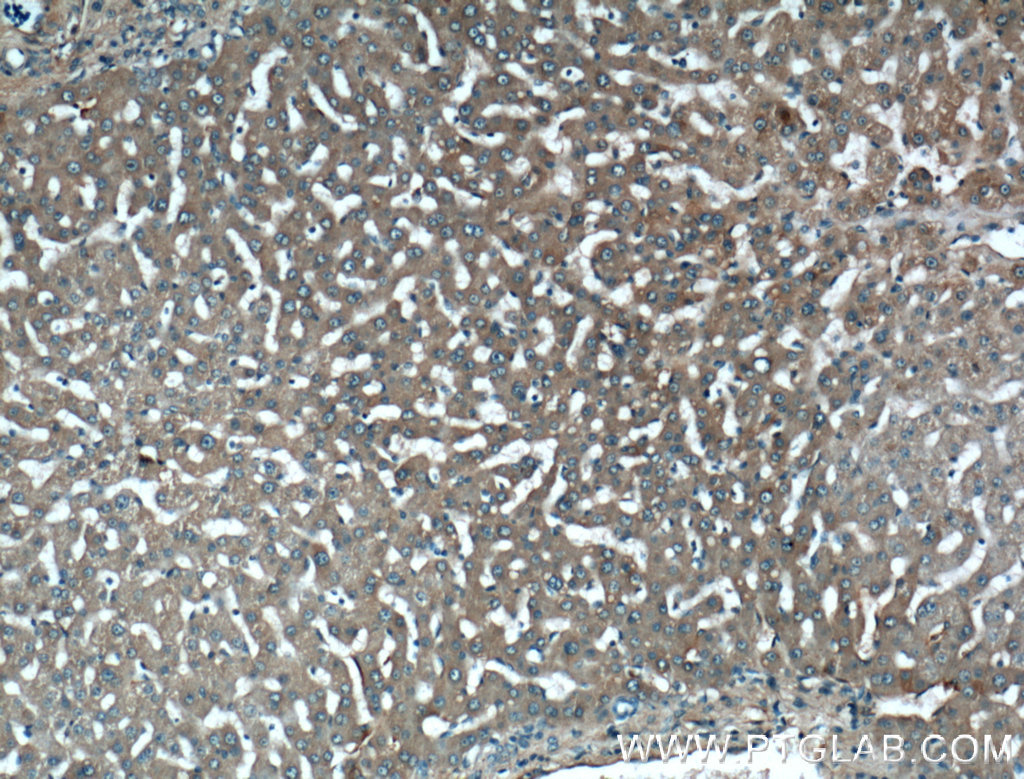 IHC staining of human liver using 20645-1-AP