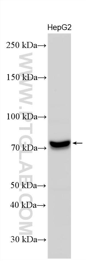 WB analysis using 20645-1-AP