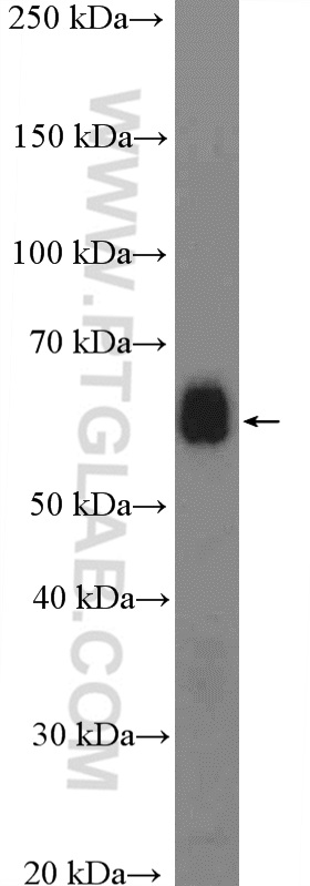 WB analysis of mouse liver using 20645-1-AP