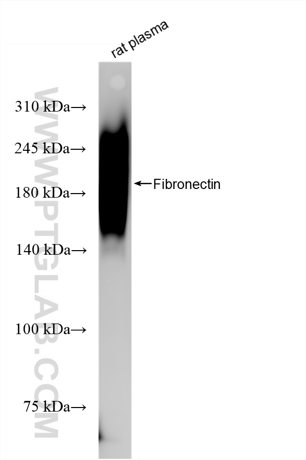 WB analysis of rat plasma using 80911-4-RR
