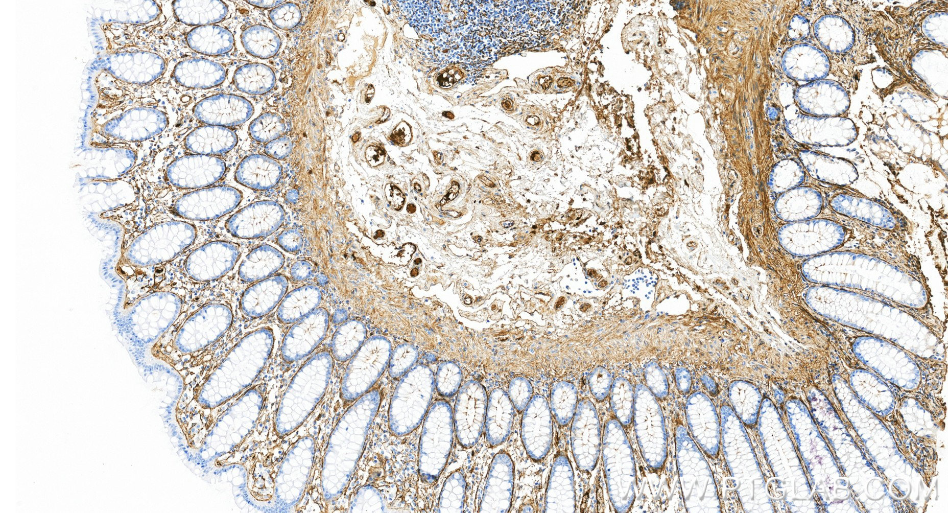 IHC staining of human colon using 98652-2-RR (same clone as 98652-2-PBS) IHC staining of human colon using 98652-2-RR (same clone as 98652-2-PBS)