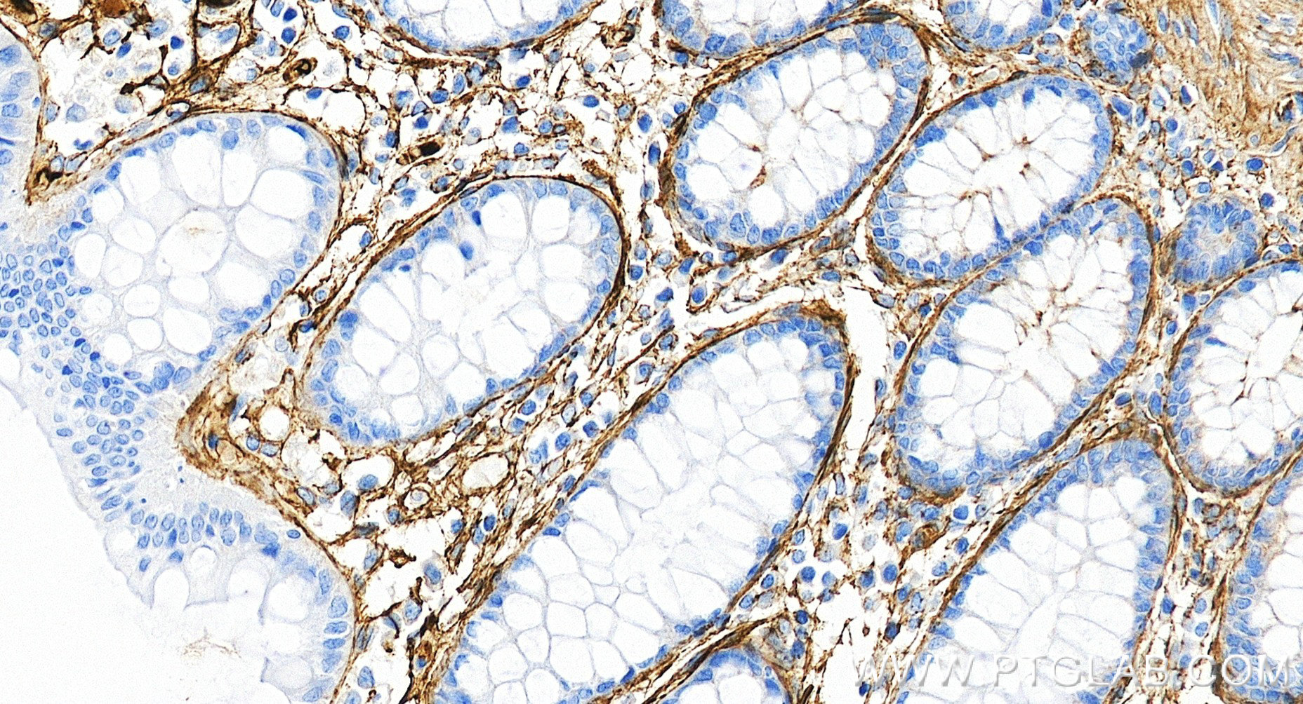 IHC staining of human colon using 98652-2-RR (same clone as 98652-2-PBS) IHC staining of human colon using 98652-2-RR (same clone as 98652-2-PBS)