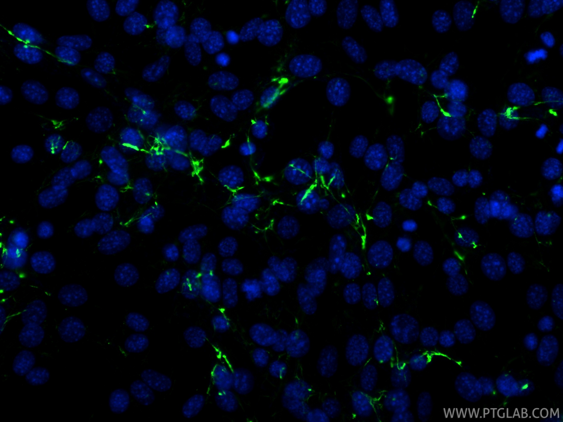 IF Staining of NIH/3T3 using 98652-2-RR (same clone as 98652-2-PBS) IF Staining of NIH/3T3 using 98652-2-RR (same clone as 98652-2-PBS)